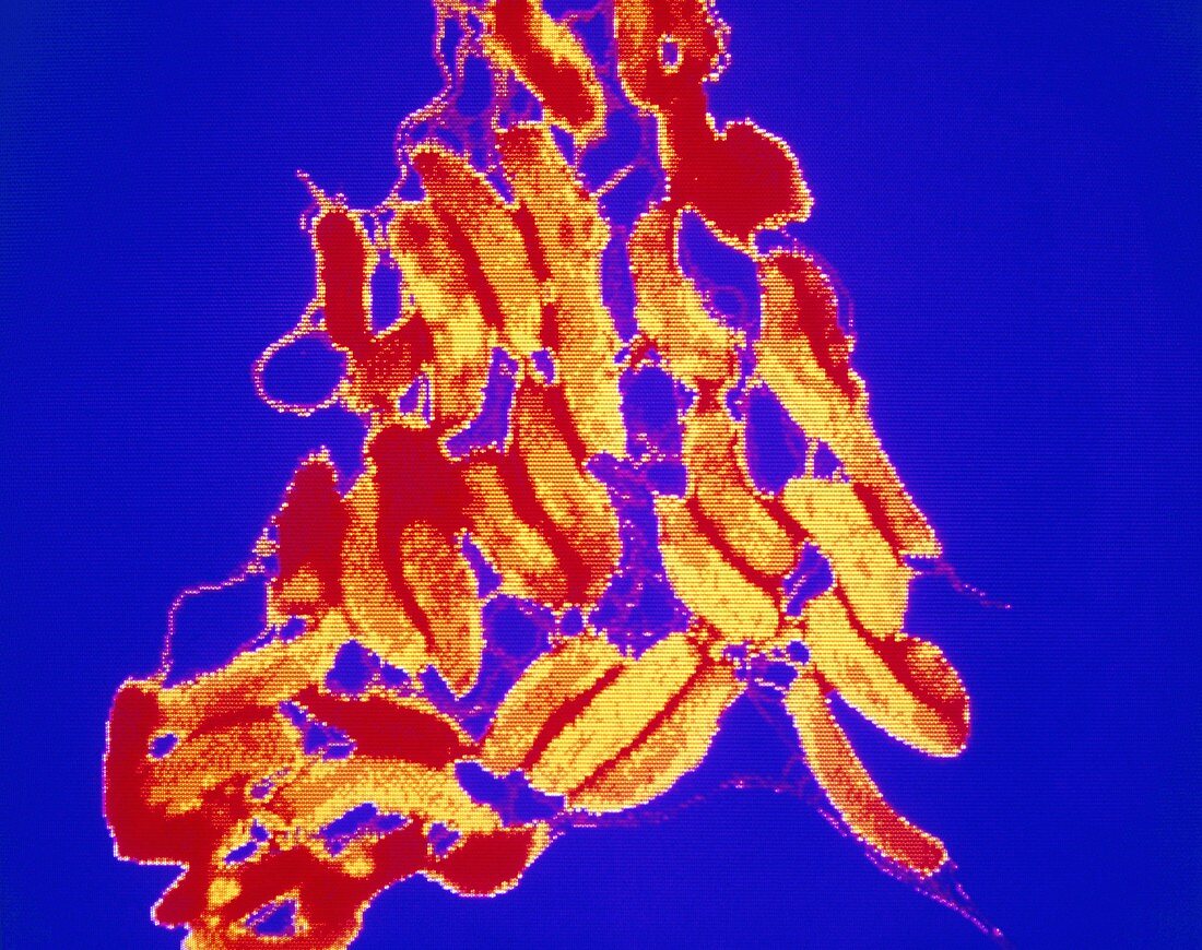 F/col TEM of Vibrio cholerae bacterium