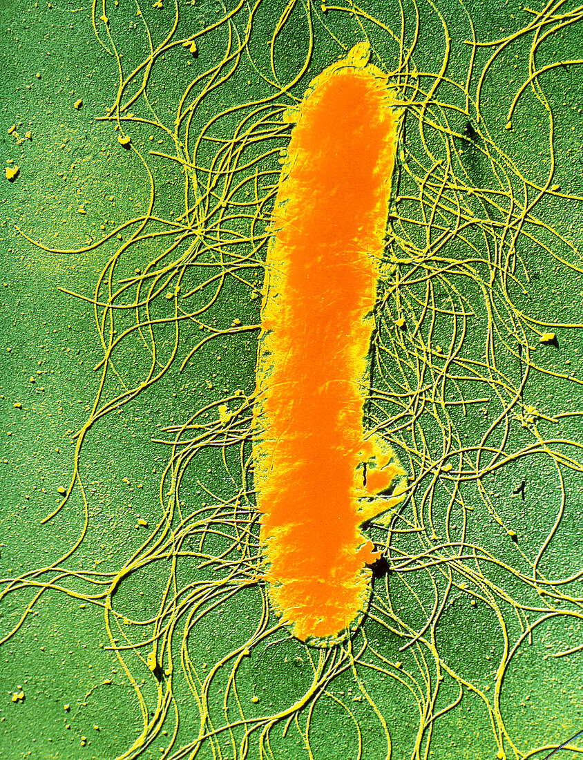 Proteus mirabilis bacterium