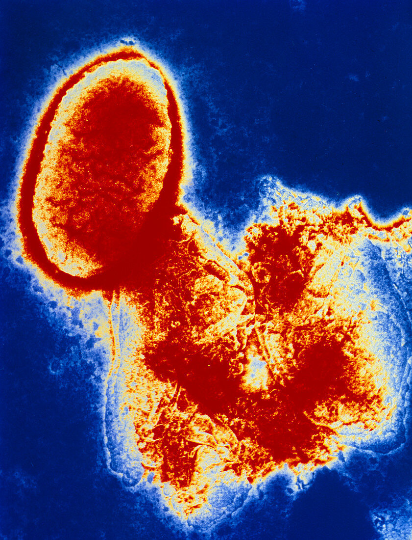 Haemophilus influenzae bacterium