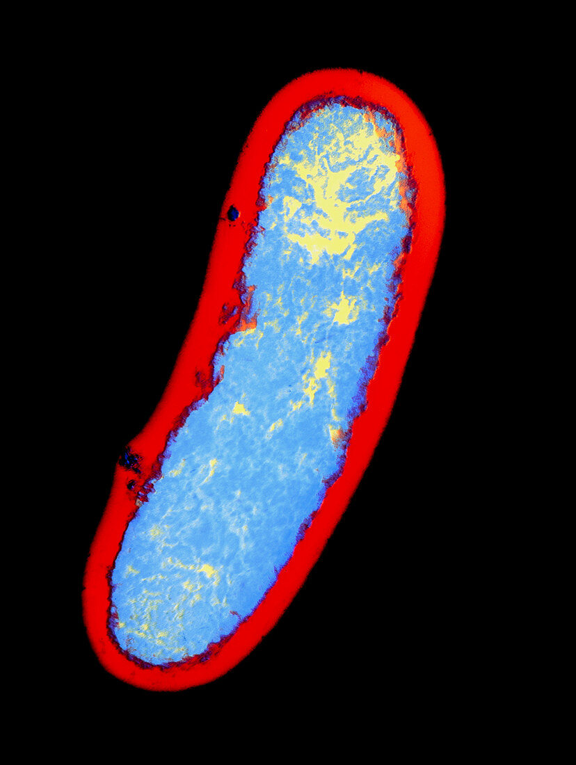 Yersinia pestis bacterium