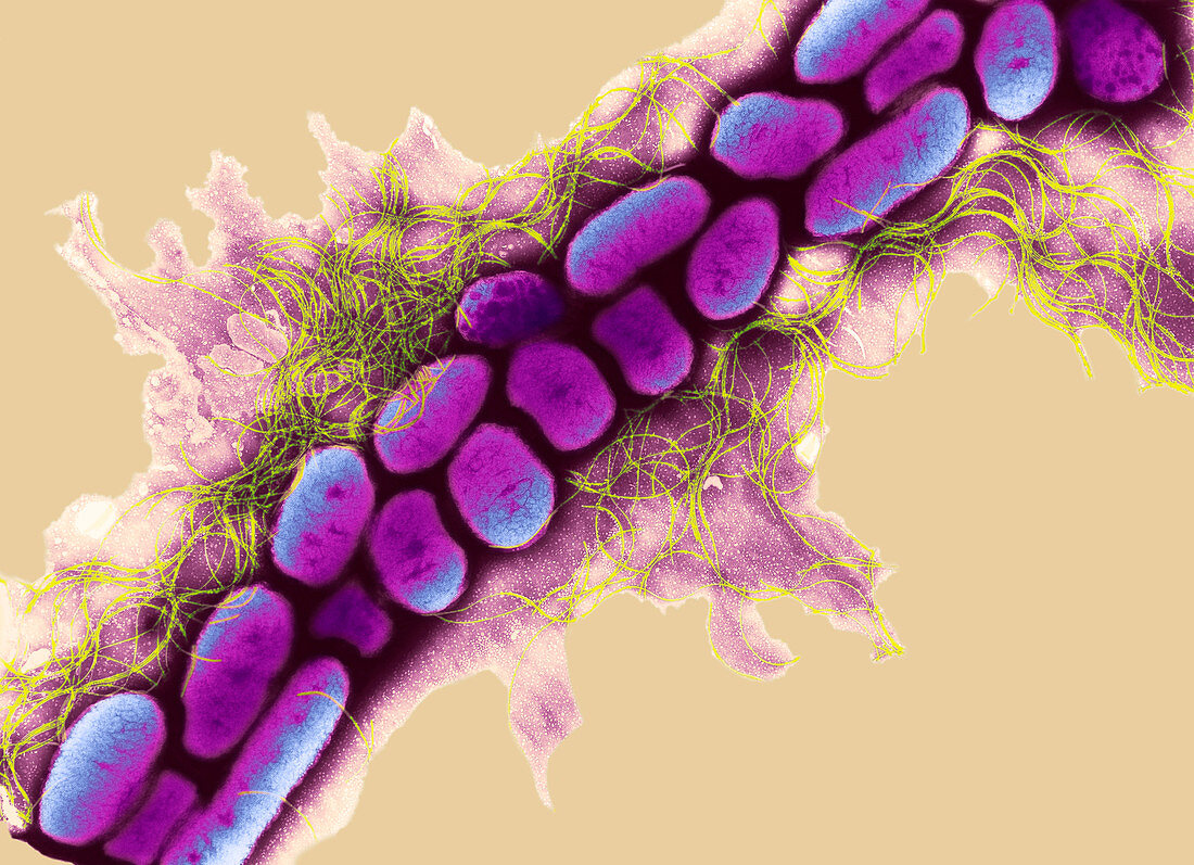 Erwinia bacteria,TEM