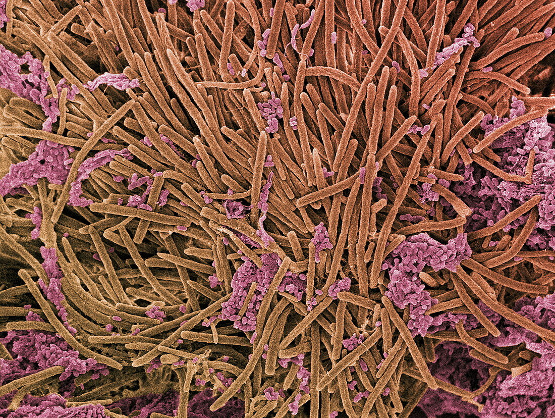 Tongue bacteria,SEM