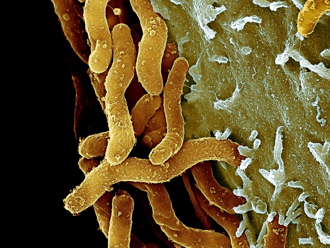 Helicobacter pylori bacteria,SEM