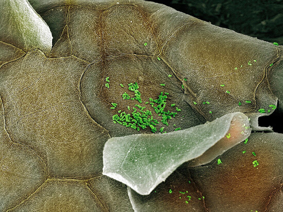 Bacteria in the nose,SEM