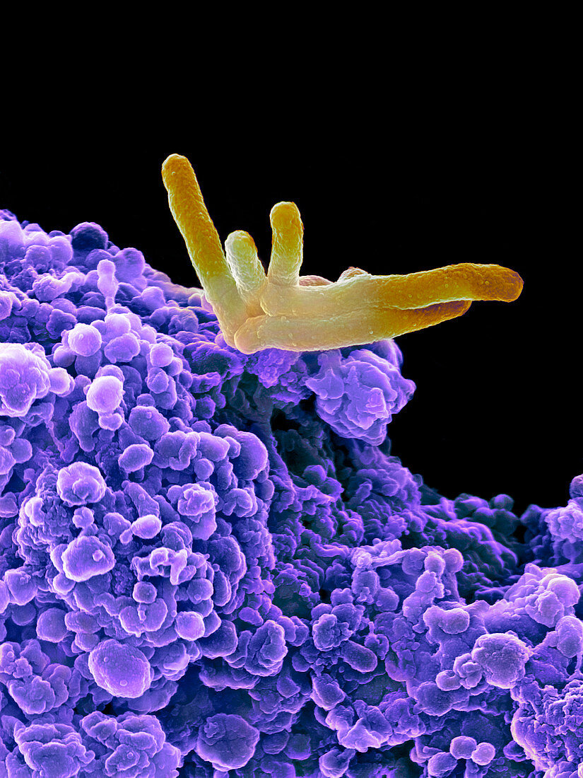 Bacteria infecting a macrophage,SEM