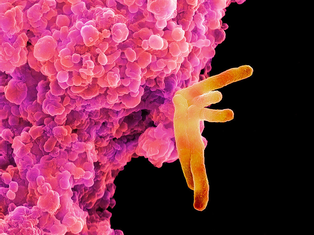 Bacteria infecting a macrophage,SEM