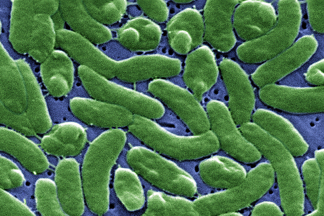 Vibrio vulnificus bacteria,SEM