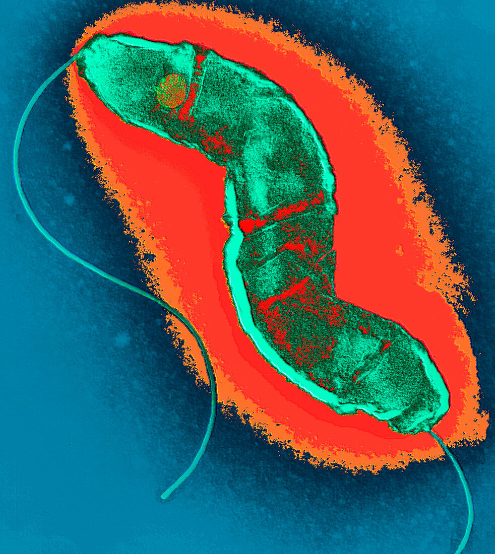 Campylobacter bacterium,TEM