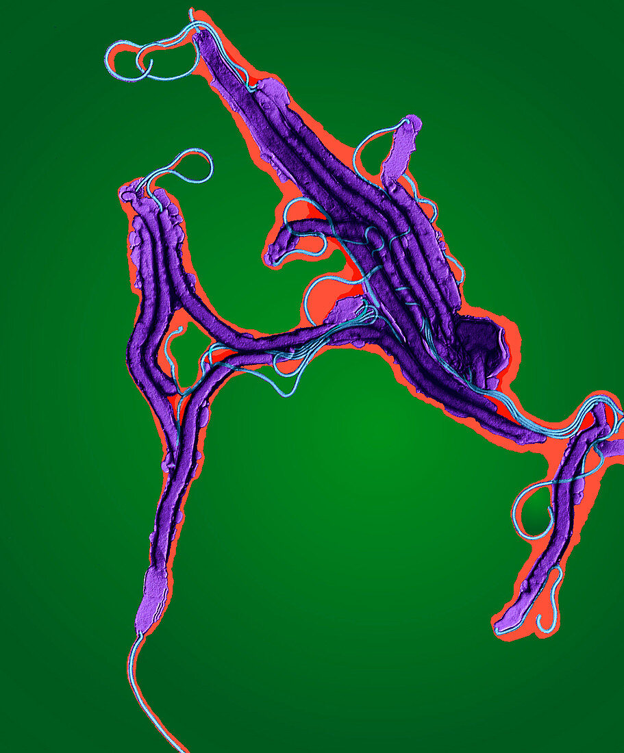 Helicobacter bacteria,TEM