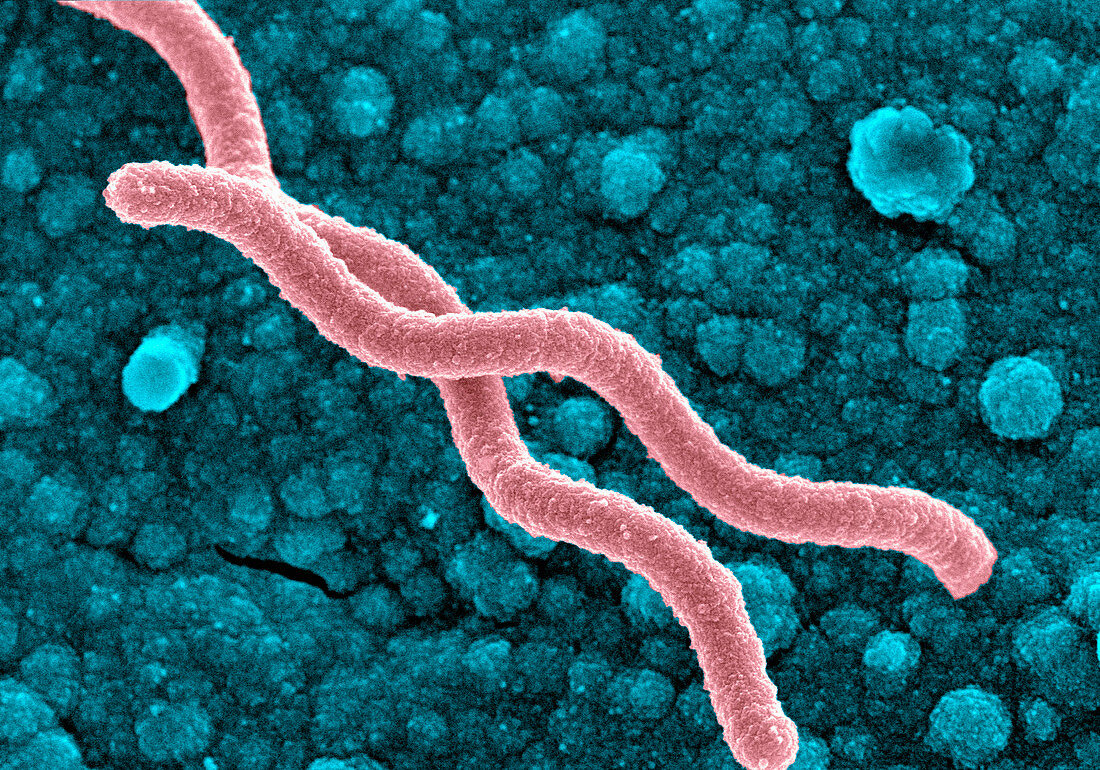 Helicobacter pylori bacteria