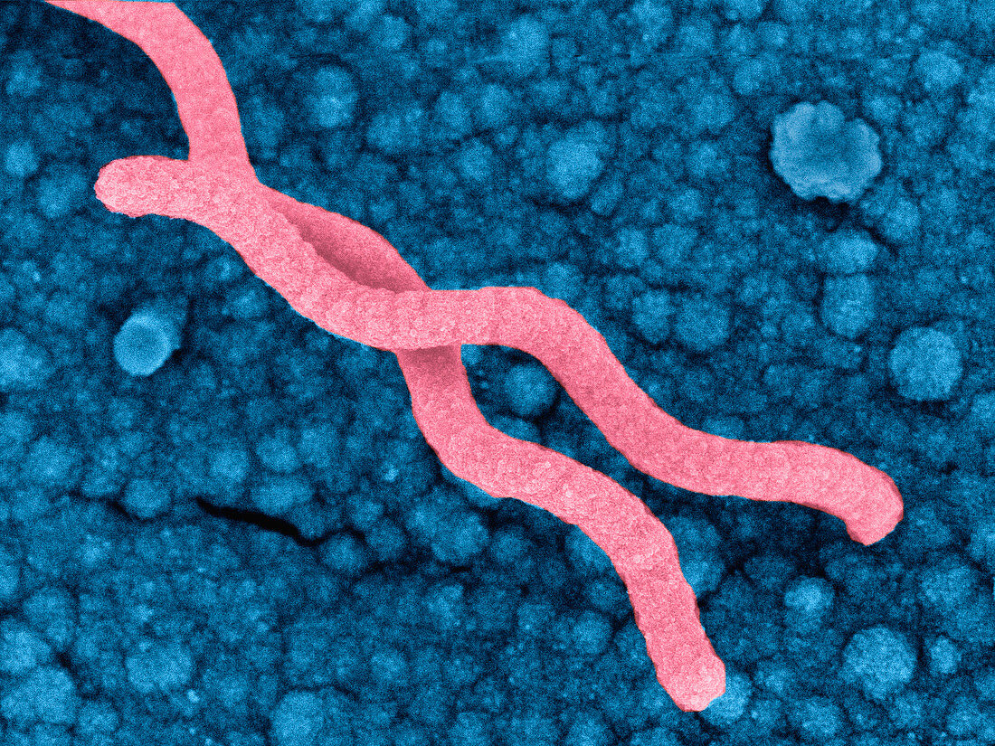 Helicobacter pylori bacteria,SEM