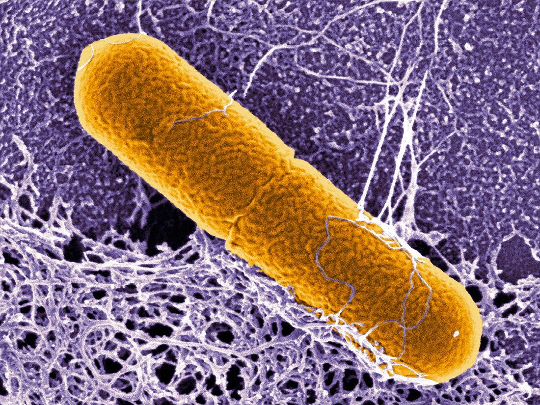 Clostridium botulinum bacterium