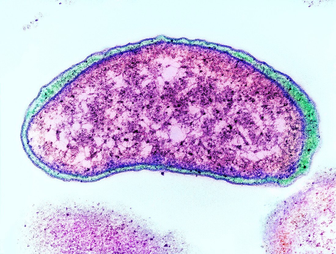 Vibrio cholerae bacterium,TEM