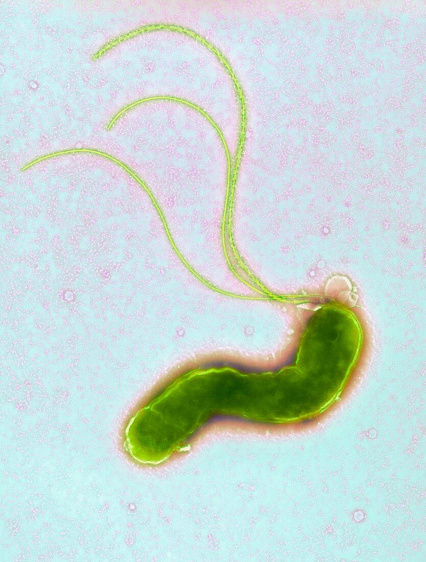 Helicobacter pylori bacterium