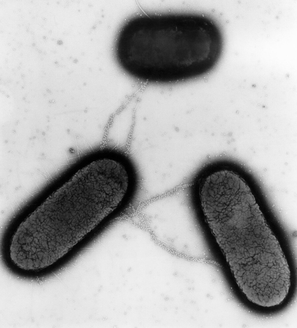 TEM of Escherichia coli