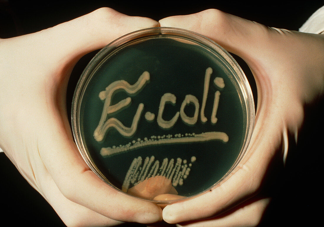Petri dish culture of colonies E. coli