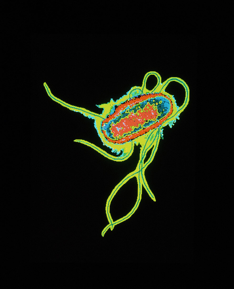 TEM of Escherichia coli bacteria