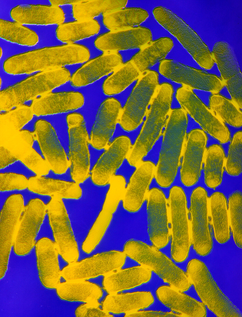 Escherichia coli 0157:H7 bacteria