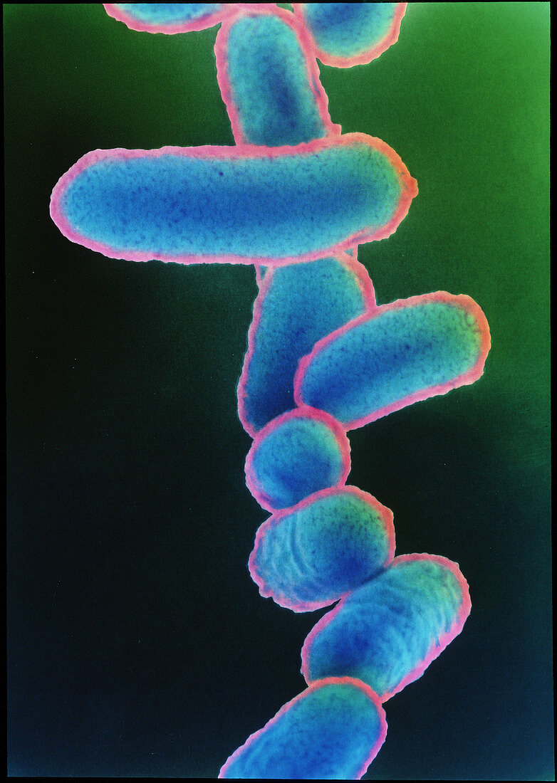 Escherichia coli 0157:H7 bacteria