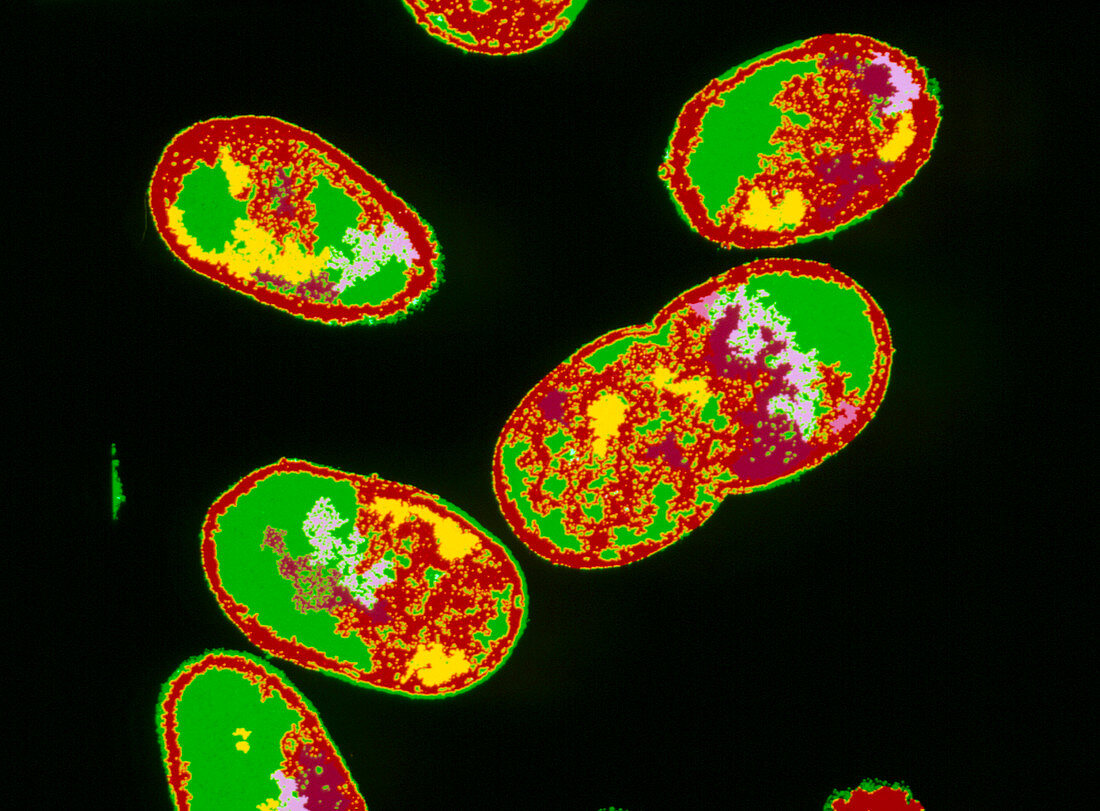 Coloured TEM of Escherichia coli bacteria