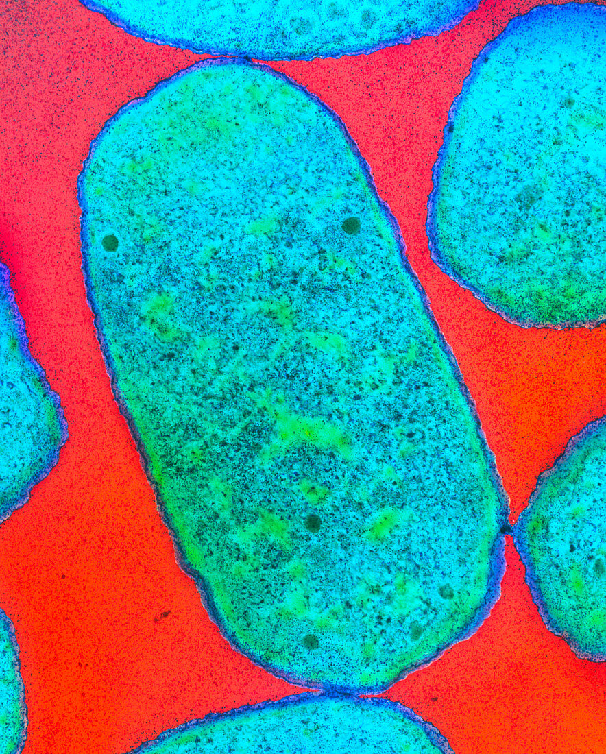 E. coli 0111 bacteria