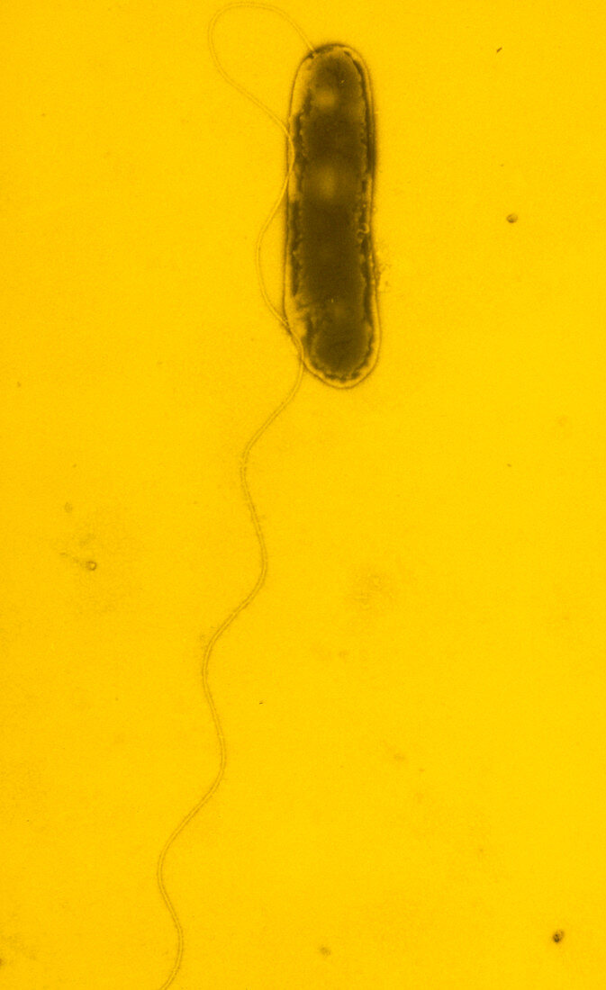 False col TEM of Legionella pneumophila
