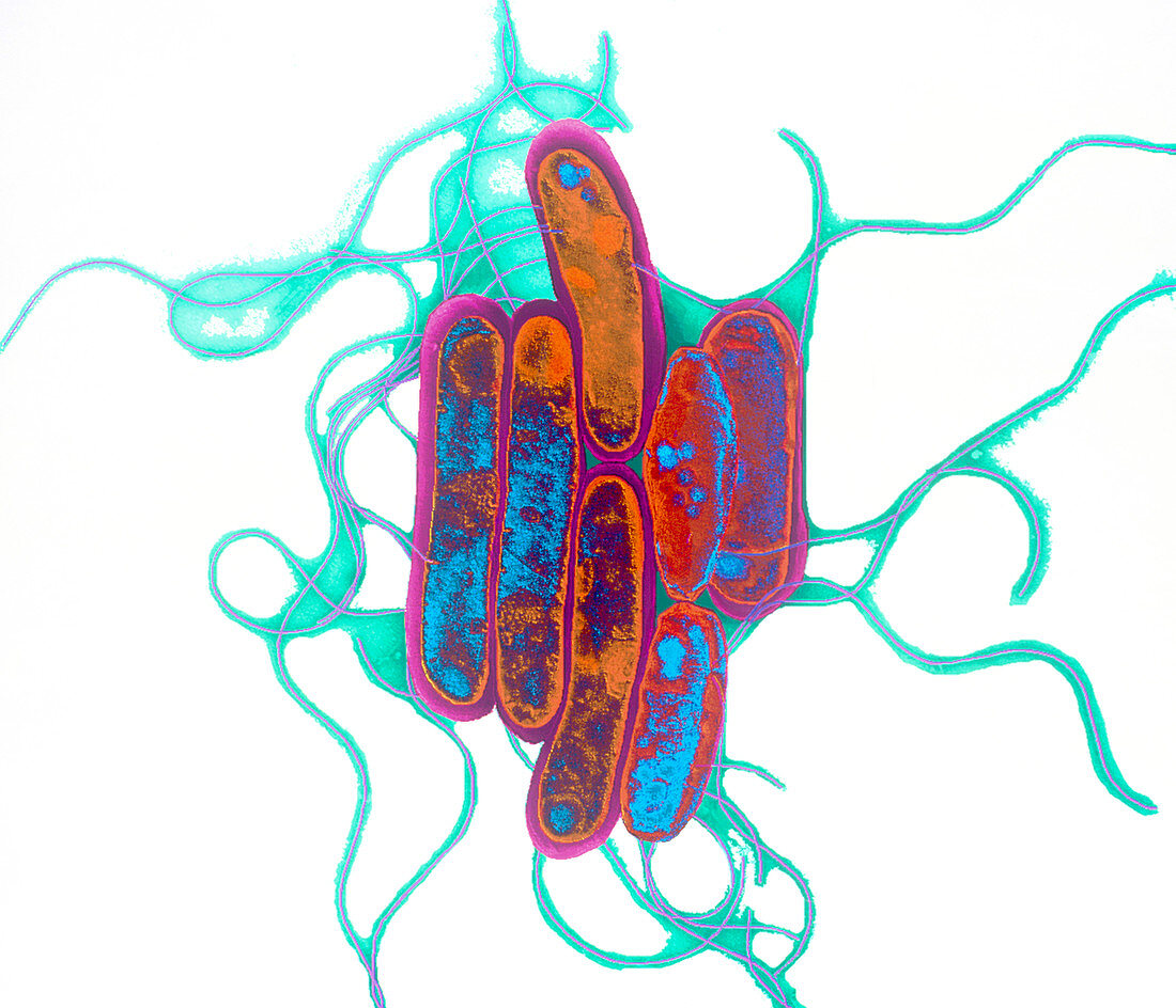 Legionella bacteria