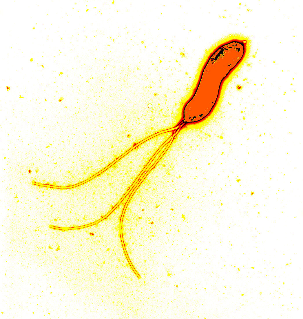 Helicobacter pylori bacterium,TEM