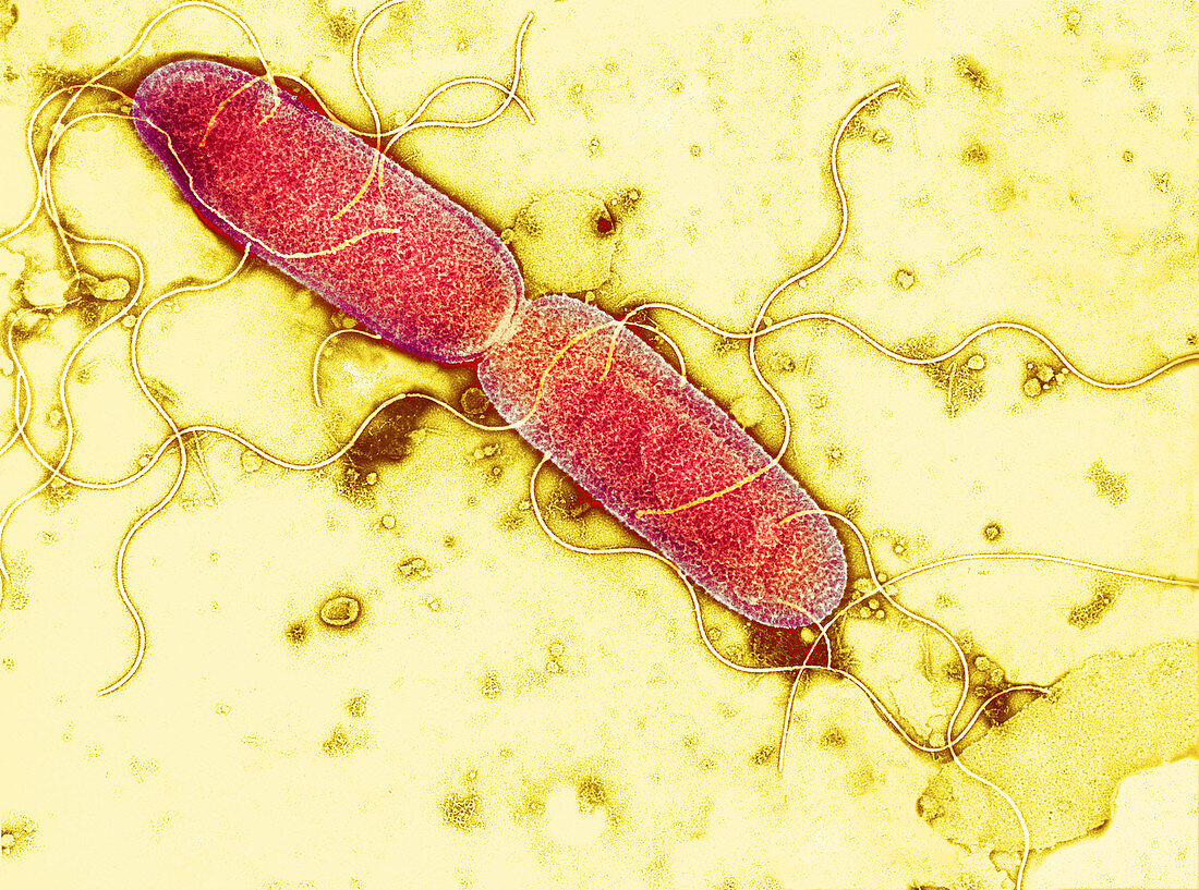 Gut bacterium reproducing,TEM