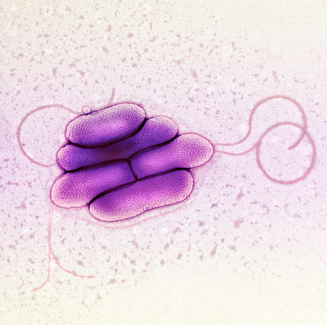 S. maltophilia bacteria,TEM