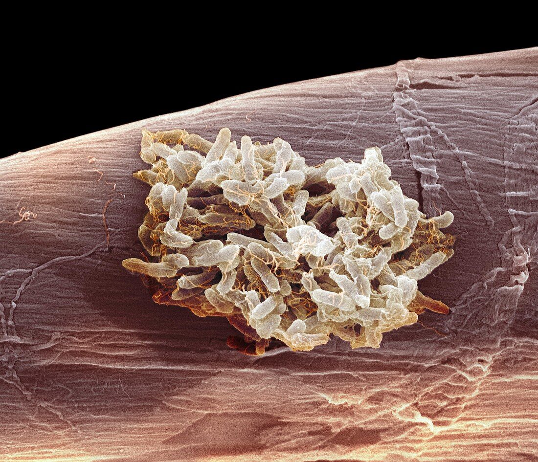 Salmonella typhimurium bacteria,SEM