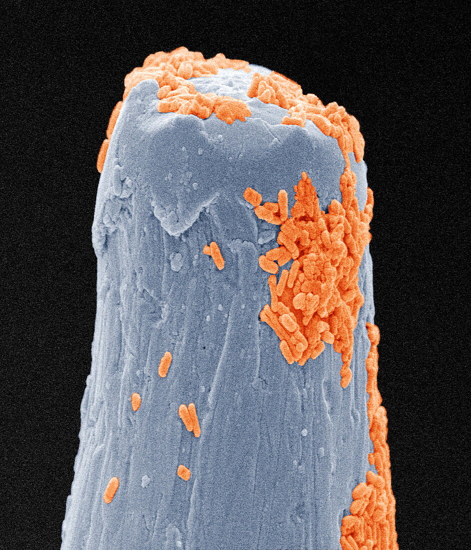 Bacteria on a pin,SEM