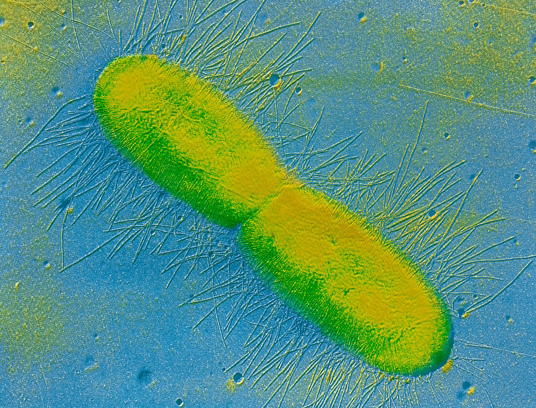 TEM of E. coli bacterium