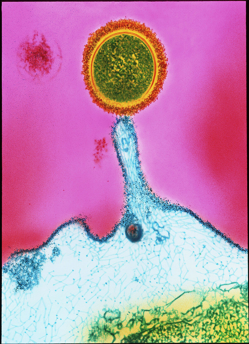 TEM of streptococcus bacterium on tonsil