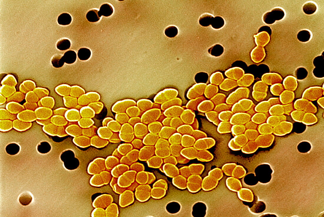 Drug-resistant bacteria,SEM