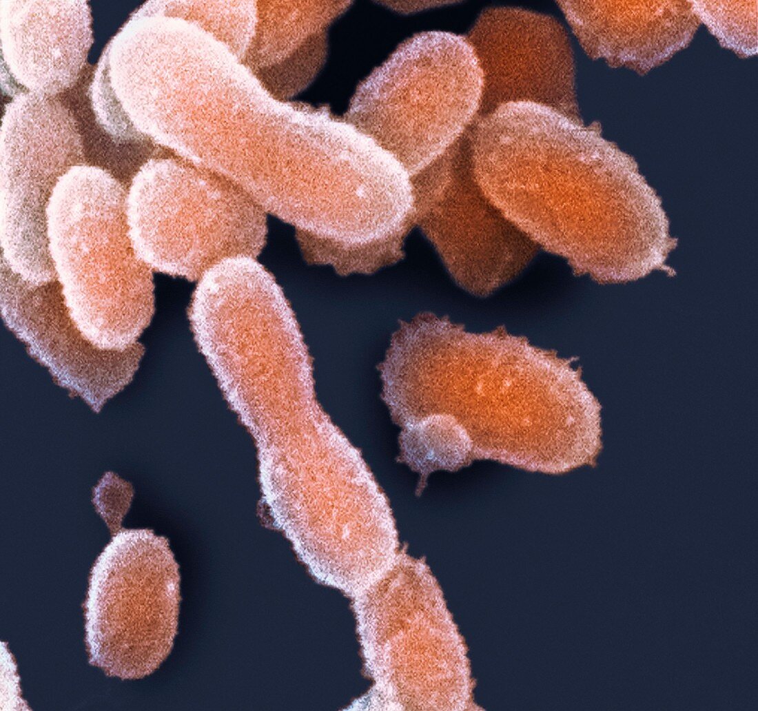 Ultra-small extremophile bacteria,SEM