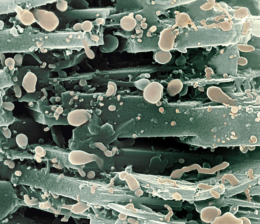Nanobacteria
