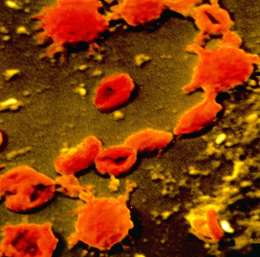 False-colour SEM of Mycoplasma pneumoniae