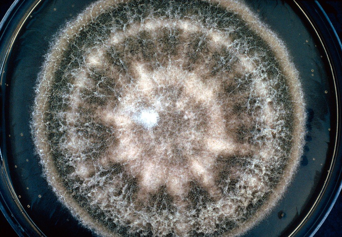Light micrograph of Aspergillus fumigatus