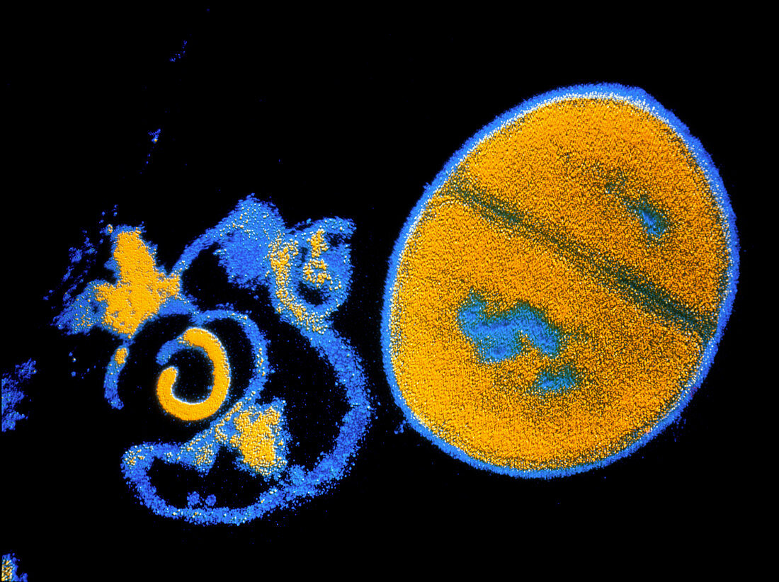 Antibiotic action on Staphylococcus