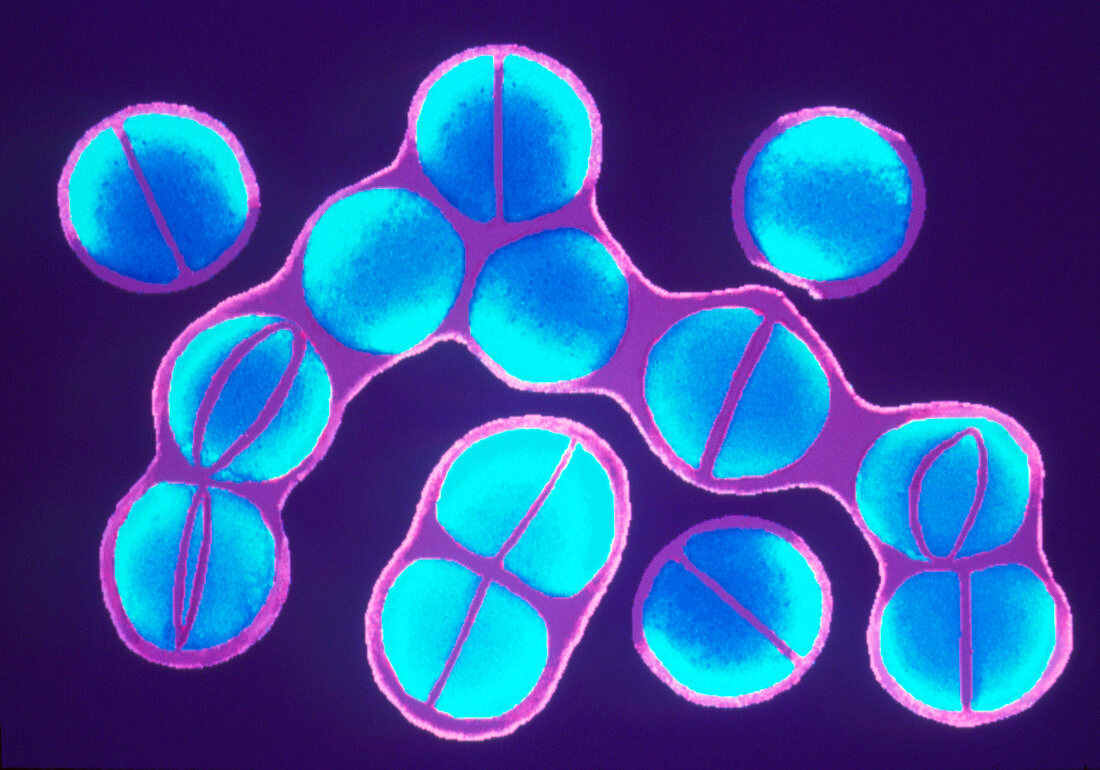 Staphylococcus aureus bacteria dividing