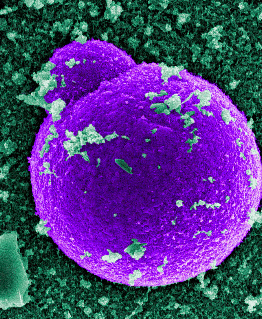 Staphylococcus aureus bacterium