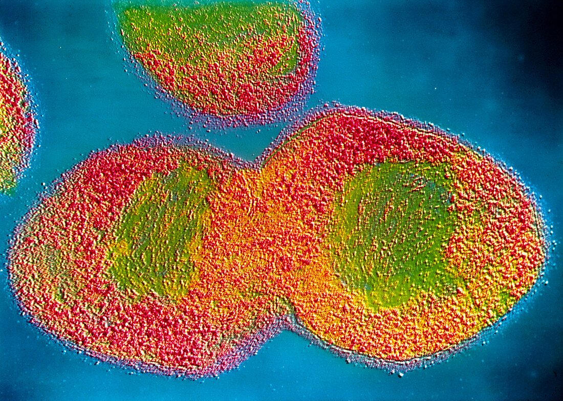 False colour TEM of Streptococcus durans