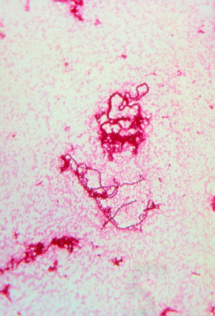 Streptococcus pyogenes chains in pus