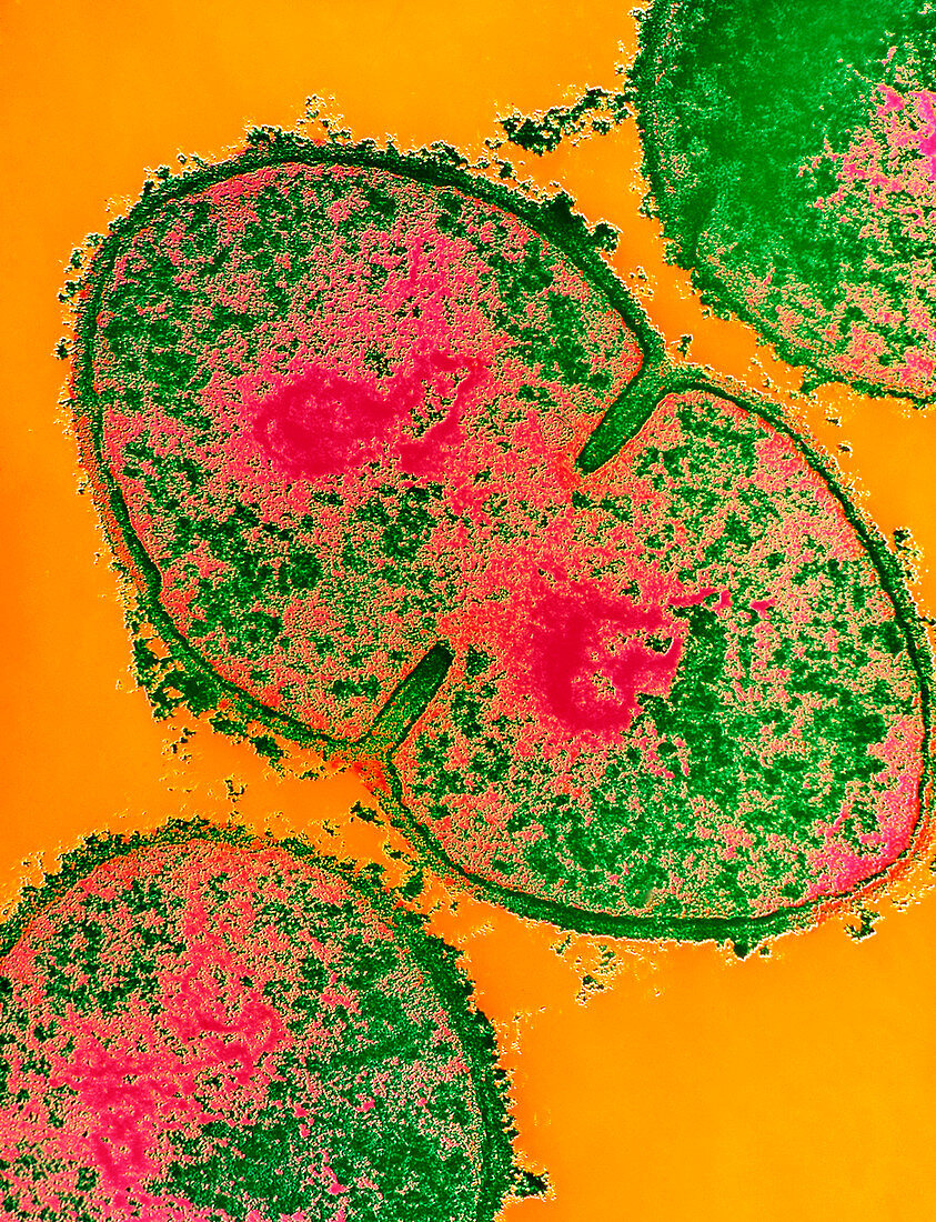 Resistant Streptococcus pyogenes strain