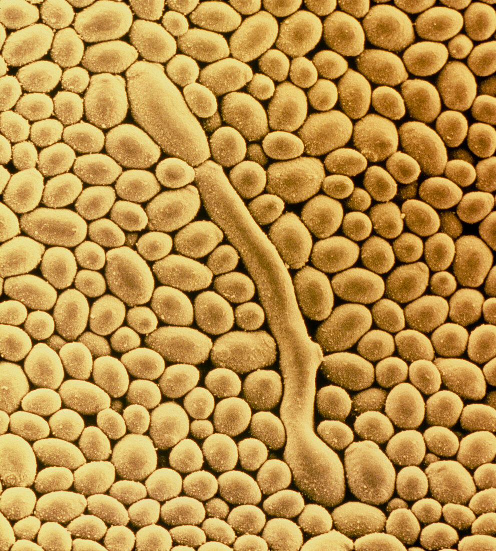Yeast cells of fungus,Candida albicans