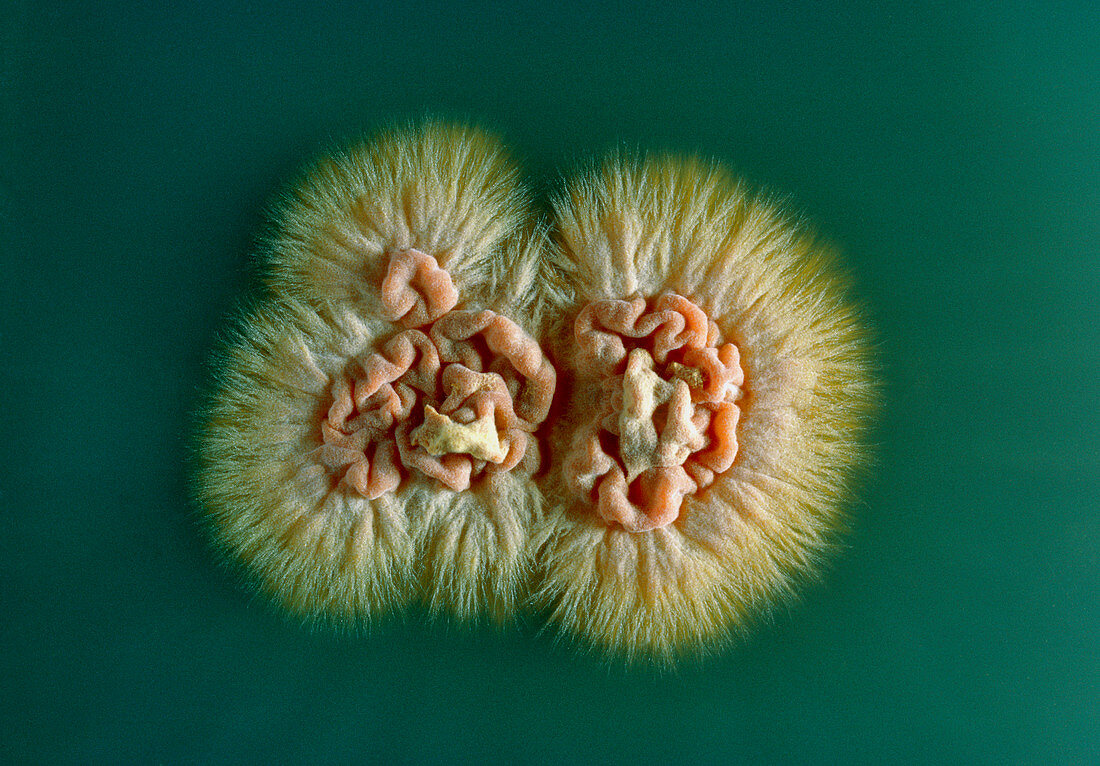 Fungus Trichophyton soudanense