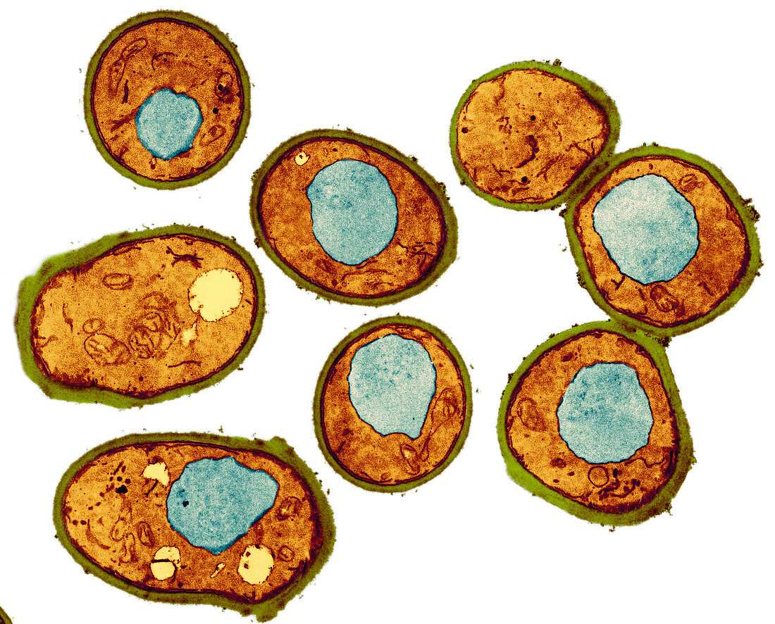 Yeast cells,TEM