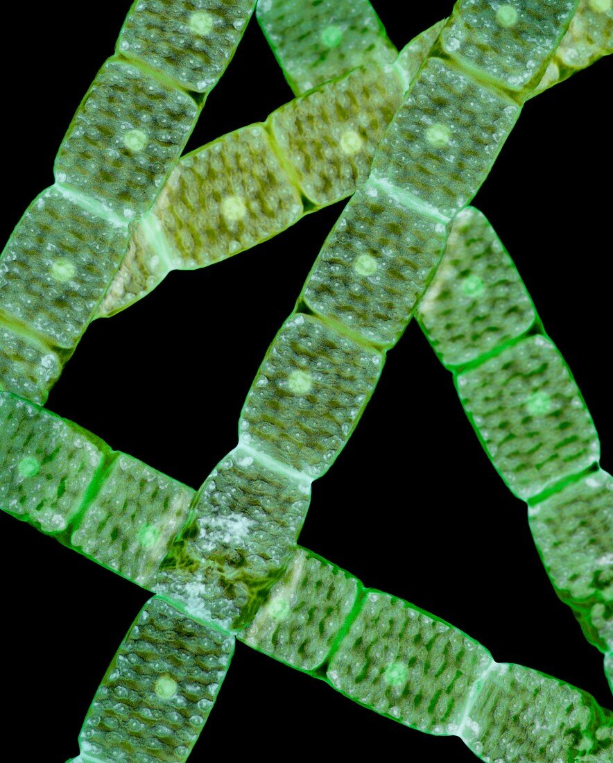 Spirogyra algae,light micrograph