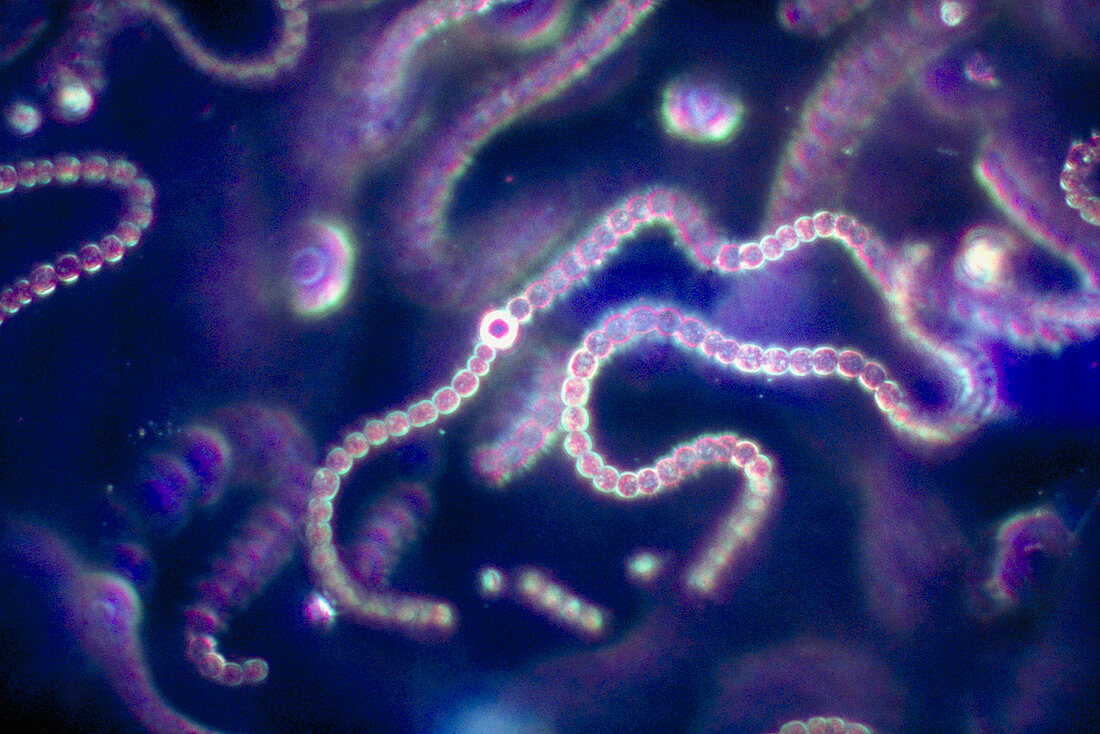 LM of Nostoc sp.,a blue-green algae